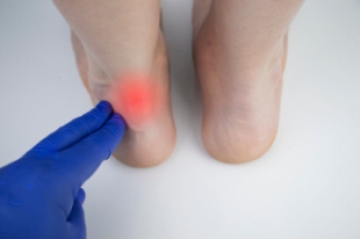 Achilles Pain From Achilles Tendinopathy